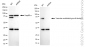 KD-Validated Anti-Vascular Endothelial Growth Factor D Rabbit Monoclonal Antibody