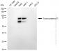 KD-Validated Anti-Tumor Protein P73 Rabbit Monoclonal Antibody