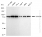 KD-Validated Anti-STAT5B Rabbit Monoclonal Antibody