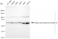 KD-Validated Anti-SLC25A12 Rabbit Monoclonal Antibody