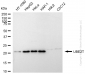 KD-Validated Anti-UBE2T Rabbit Monoclonal Antibody