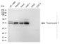 KD-Validated Anti-Tropomyosin 1 Rabbit Monoclonal Antibody
