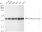 KD-Validated Anti-Somatostatin Receptor 5 Rabbit Monoclonal Antibody