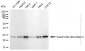 KD-Validated Anti-Superoxide Dismutase 2 Rabbit Monoclonal Antibody