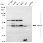 KD-Validated Anti-SMYD3 Rabbit Monoclonal Antibody