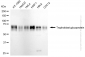 KD-Validated Anti-Trophoblast Glycoprotein Rabbit Monoclonal Antibody