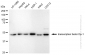 KD-Validated Anti-Transcription Factor Dp-1 Rabbit Monoclonal Antibody