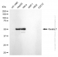 KD-Validated Anti-Keratin 7 Rabbit Monoclonal Antibody