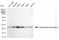 KD-Validated Anti-Superoxide Dismutase 2 Mouse Monoclonal Antibody
