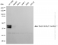 KD-Validated Anti-Serpin Family E Member 1 Rabbit Monoclonal Antibody