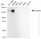KD-Validated Anti-Epidermal Growth Factor Receptor Rabbit Monoclonal Antibody