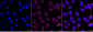 KD-Validated Anti-Integrin alpha V Rabbit Monoclonal Antibody