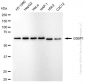 KD-Validated Anti-G3BP1 Rabbit Monoclonal Antibody