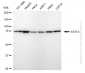 KD-Validated Anti-STAT3 Rabbit Monoclonal Antibody