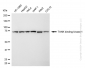 KD-Validated Anti-TANK Binding Kinase 1 Rabbit Monoclonal Antibody