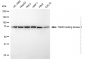 KD-Validated Anti-TANK Binding Kinase 1 Rabbit Monoclonal Antibody