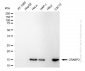 KD-Validated Anti-CRABP2 Rabbit Monoclonal Antibody