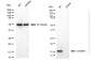 KD-Validated Anti-CRABP2 Rabbit Monoclonal Antibody