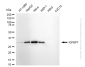 KD-Validated Anti-IGFBP7 Rabbit Monoclonal Antibody