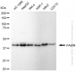 KD-Validated Anti-Pro-Apoptotic WT1 Regulator Rabbit Monoclonal Antibody