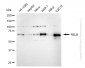 KD-Validated Anti-RELB Rabbit Monoclonal Antibody