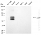 KD-Validated Anti-ALPP Rabbit Monoclonal Antibody