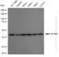 KD-Validated Anti-AP3M1 Rabbit Monoclonal Antibody
