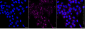 KD-Validated Anti-ERBB2 Mouse Monoclonal Antibody