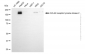 KD-Validated Anti-ERBB2 Mouse Monoclonal Antibody