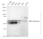 KD-Validated Anti-Glutaminase Rabbit Monoclonal Antibody