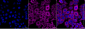 KD-Validated Anti-PFKP Mouse Monoclonal Antibody