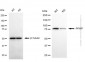 KD-Validated Anti-PFKP Mouse Monoclonal Antibody