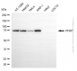 KD-Validated Anti-PFKP Mouse Monoclonal Antibody