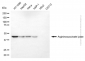 KD-Validated Anti-Argininosuccinate Lyase Mouse Monoclonal Antibody