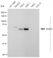 KD-Validated Anti-IRAK3 Rabbit Monoclonal Antibody