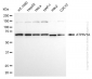 KD-Validated Anti-ATP6V1A Rabbit Monoclonal Antibody