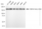 KD-Validated Anti-Clathrin Heavy Chain Rabbit Monoclonal Antibody