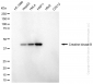 KD-Validated Anti-Creatine Kinase B Mouse Monoclonal Antibody