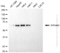 KD-Validated Anti-EIF2AK2 Mouse Monoclonal Antibody