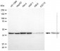 KD-Validated Anti-FBXO22 Mouse Monoclonal Antibody
