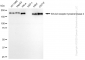 KD-Validated Anti-Erb-b2 receptor tyrosine kinase 2 Rabbit Monoclonal Antibody