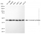 KD-Validated Anti-FumaRate HydRatase Mouse Monoclonal Antibody