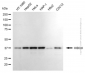 KD-Validated Anti-HIBCH Mouse Monoclonal Antibody