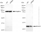 KD-Validated Anti-Sirtuin 5 Mouse Monoclonal Antibody