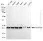KD-Validated Anti-NDUFB10 Mouse Monoclonal Antibody