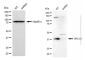 KD-Validated Anti-XRCC3 Mouse Monoclonal Antibody