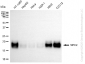 KD-Validated Anti-NPC2 Rabbit Monoclonal Antibody