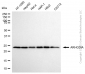 KD-Validated Anti-ARHGDIA Rabbit Monoclonal Antibody