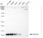 KD-Validated Anti-NDUFB1 Rabbit Monoclonal Antibody