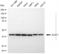 KD-Validated Anti-ACAT1 Rabbit Polyclonal Antibody